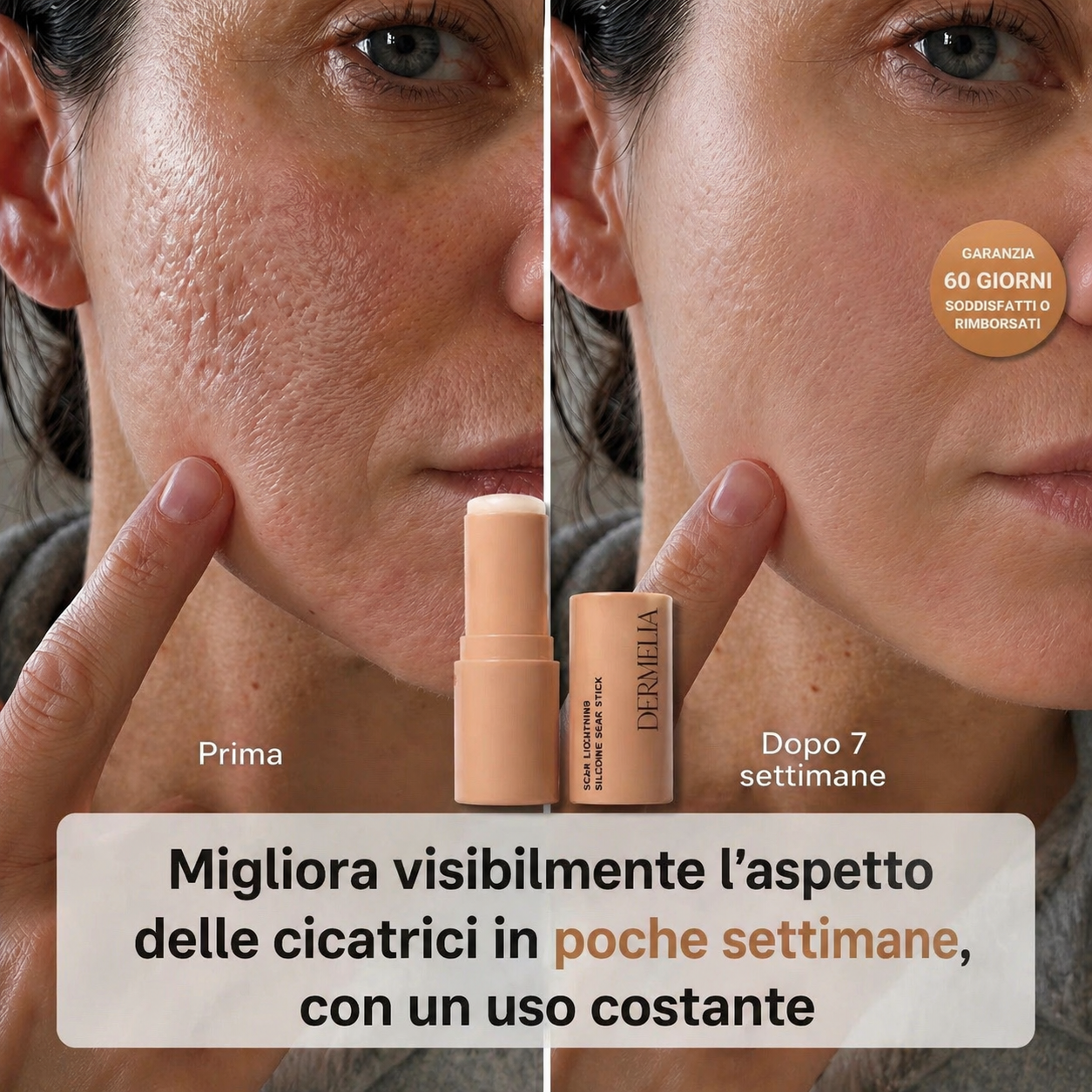 DERMELIA™ Repair - Il primo trattamento a barriera prolungata per ogni tipo di cicatrice