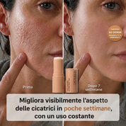 DERMELIA™ Repair - Il primo trattamento a barriera prolungata per ogni tipo di cicatrice