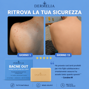 Dermelia Bacne Out